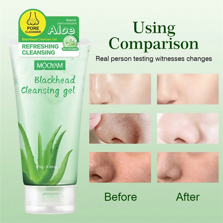 MOOYAM Aloe Vera Blackhead Cleansing Gel – Deep Pore Cleanse For Fresh, Smooth Skin